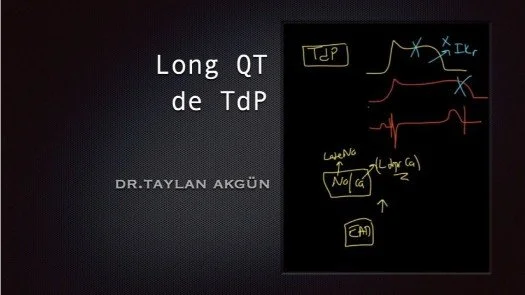 ⁣Long QT de TdP