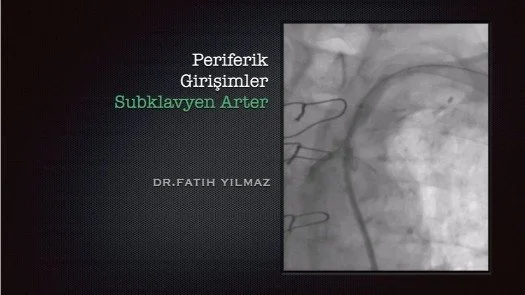 Periferik Girişimler - Subklavyen Arter-1