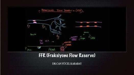 FFR (Fraksiyone Flow Reserve)