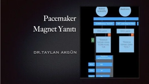 ⁣Pacemaker Magnet Yanıtı