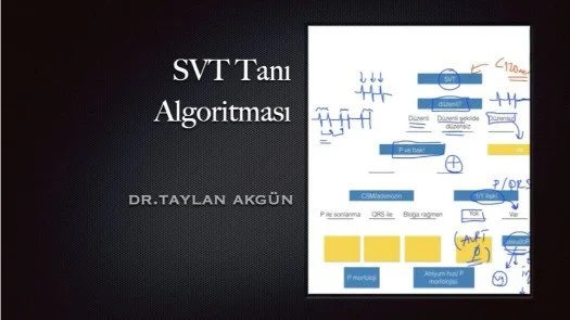 ⁣SVT Tanı Algoritması