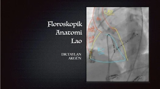 ⁣Floroskopik Anatomi-LAO