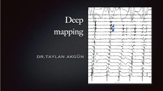 Deep mapping