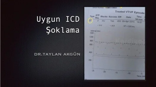 Uygun ICD Şoklama