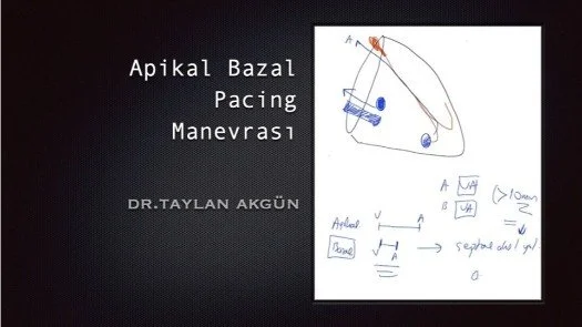 ⁣Apikal Bazal Pacing Manevrası