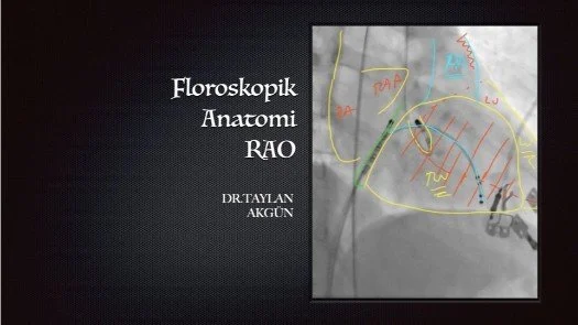 ⁣Floroskopik Anatomi-RAO