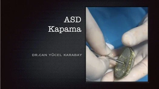 ASD Kapama