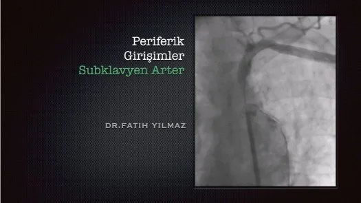 Periferik Girişimler - Subklavyen Arter-2