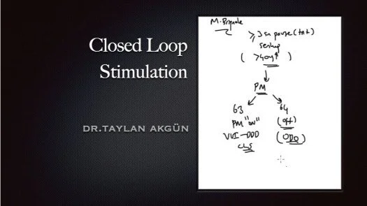 Closed Loop Stimulation