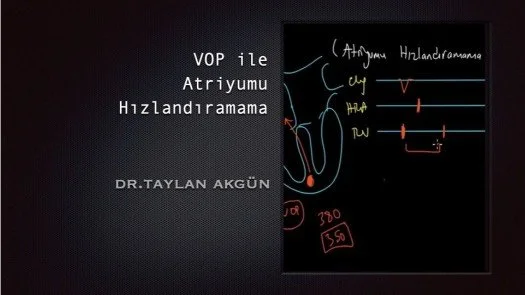 VOP ile Atriyumu Hızlandıramama