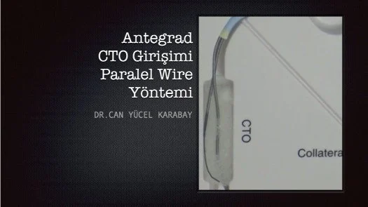 ⁣Antegrad CTO Girişimi(Paralel Wire Yöntemi)