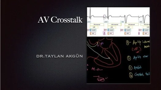 AV Crosstalk