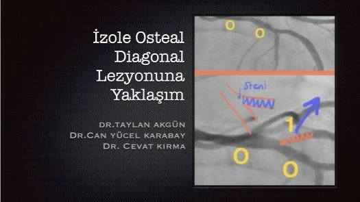 ⁣İzole Osteal Diagonal Lezyonuna Yaklaşım