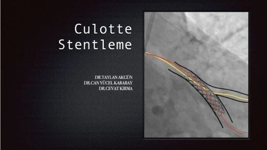 Culotte Stentleme