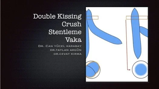 ⁣Double Kissing Crush Stentleme Vaka
