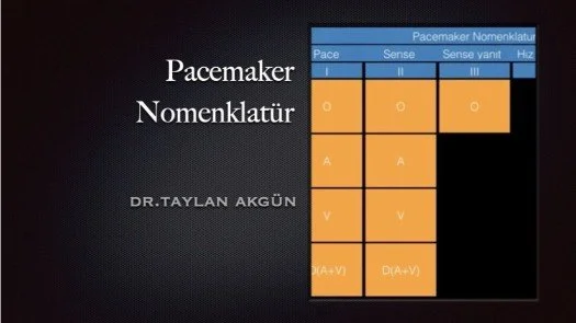 ⁣Pacemaker Nomenklatür