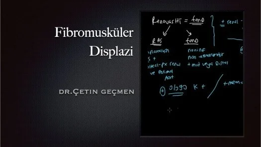 Fibromusküler Displazi