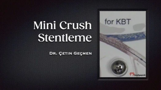 Mini Crush Stentleme