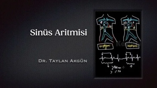 ⁣Sinüs Aritmisi