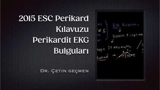 ⁣2015 ESC Perikard Kılavuzu-Perikardit EKG Bulguları