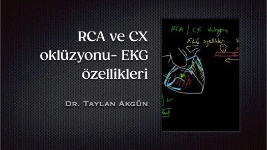 ⁣RCA ve CX oklüzyonu- EKG özellikleri