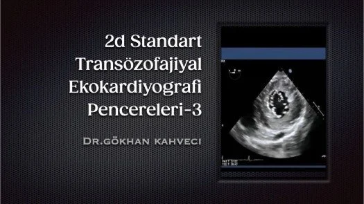 ⁣2d Standart Transözofajiyal Ekokardiyografi Pencereleri-3