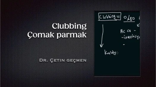 Clubbing - Çomak parmak