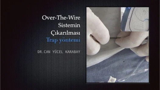 ⁣Over-The-Wire Sistemin Çıkarılması(trap yöntemi)
