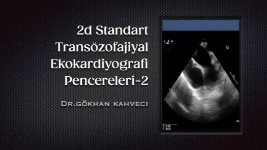 ⁣2d Standart Transözofajiyal Ekokardiyografi Pencereleri-2