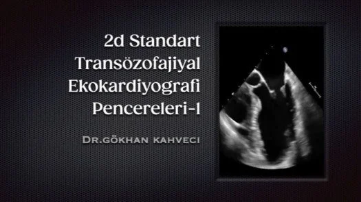 ⁣2d Standart Transözofajiyal Ekokardiyografi Pencereleri-1