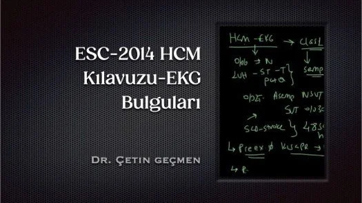 ⁣ESC-2014 HCM Kılavuzu-EKG Bulguları
