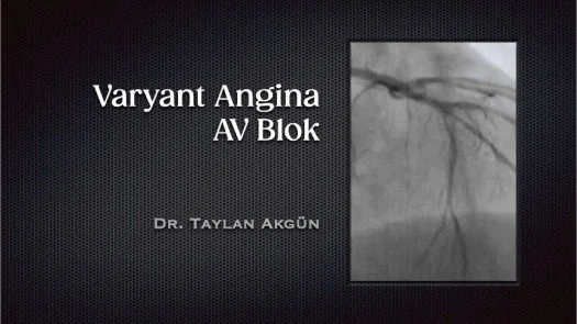 ⁣Varyant Angina-AV Blok