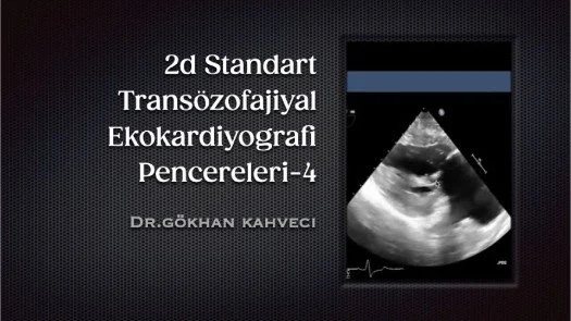 ⁣2d Standart Transözofajiyal Ekokardiyografi Pencereleri-4