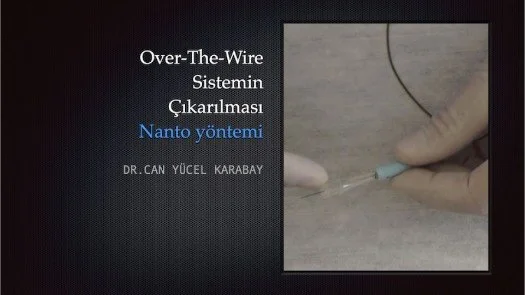 ⁣Over-The-Wire Sistemin Çıkarılması(nanto yöntemi)