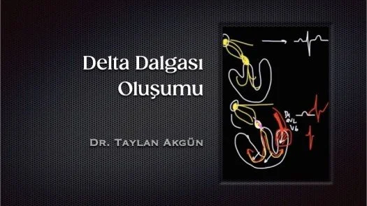 ⁣Delta Dalgası Oluşumu