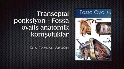 ⁣Transeptal ponksiyon- Fossa ovalis anatomik komşuluklar